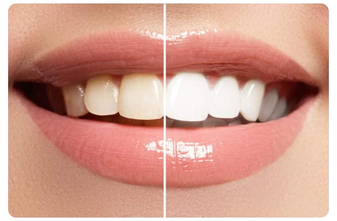 Cosmetic Dentistry