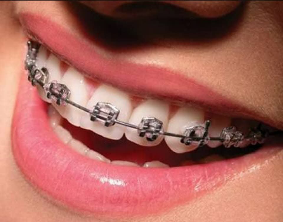 Orthodontics